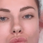 Oplas Akibat Filter Medsos