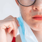 Krim Steroid Wajah Rusak