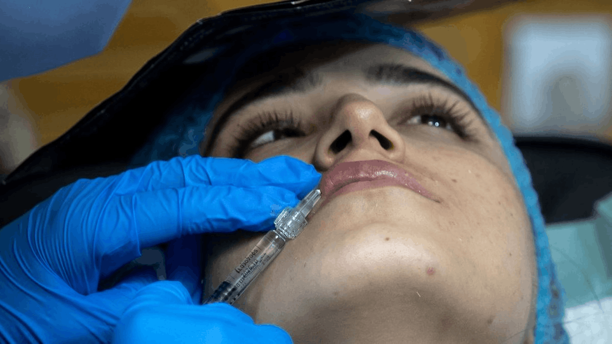 Tren operasi plastik wanita Afghanistan